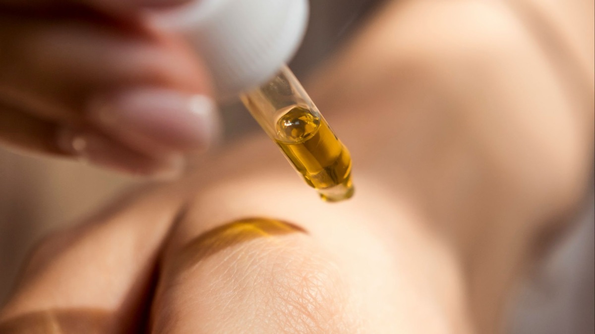5 At-Home Remedies For Breakouts